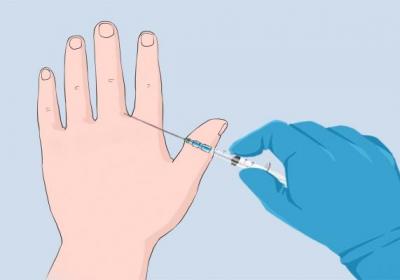 艾滋病是怎么傳染的